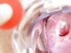 La enfermera cochina se queda solas